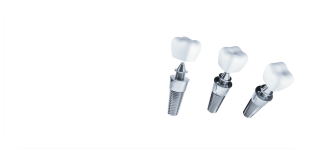 carosello-servizi-home-progetto-dentale-3-(4)